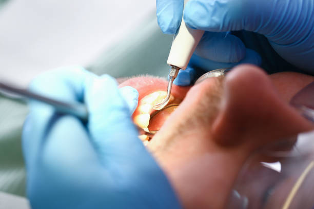 Best Emergency TMJ Treatment in Kennewick, WA