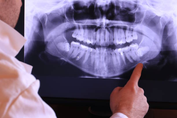 Best Emergency Dental Care for Broken or Chipped Teeth in Kennewick, WA