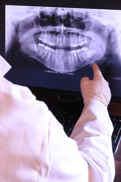 Best Emergency Wisdom Teeth Removal in Kennewick, WA